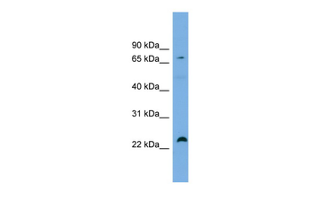SPART Rabbit Polyclonal Antibody