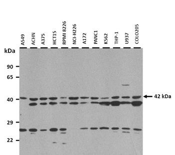 BGN Rabbit Polyclonal Antibody