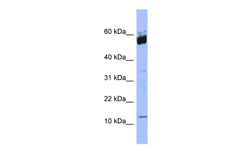 S100A9 Rabbit Polyclonal Antibody