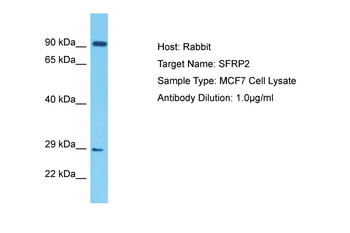 SFRP2 Rabbit Polyclonal Antibody