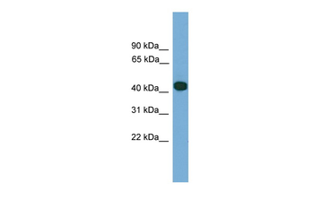 SERPINI2 Rabbit Polyclonal Antibody