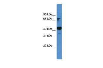 Ascc1 Rabbit Polyclonal Antibody
