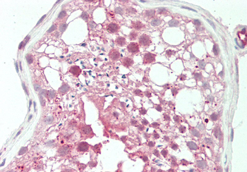 NOSIP Rabbit Polyclonal Antibody