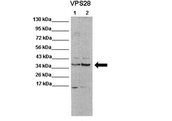VPS28 Rabbit Polyclonal Antibody