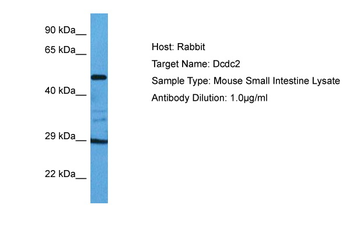 DCDC2 Rabbit Polyclonal Antibody