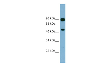 AGK Rabbit Polyclonal Antibody