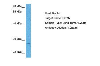 PDYN Rabbit Polyclonal Antibody