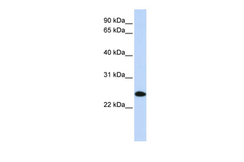UBE2K Rabbit Polyclonal Antibody