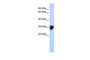 CA1 Rabbit Polyclonal Antibody