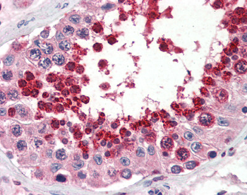 GPX4 Rabbit Polyclonal Antibody