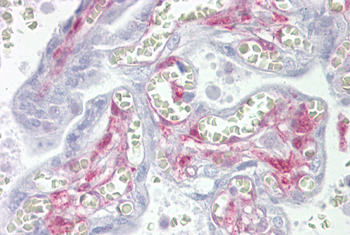 LGALS1 Rabbit Polyclonal Antibody