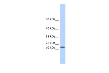 LGALS1 Rabbit Polyclonal Antibody