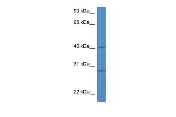 Sh3glb1 Rabbit Polyclonal Antibody