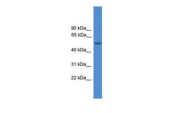 SERPINF2 Rabbit Polyclonal Antibody