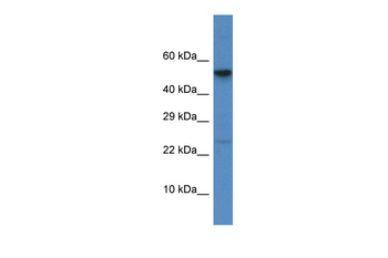 CTSC Rabbit Polyclonal Antibody