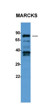 MARCKS Rabbit Polyclonal Antibody