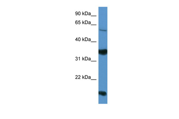 NTNG2 Rabbit Polyclonal Antibody