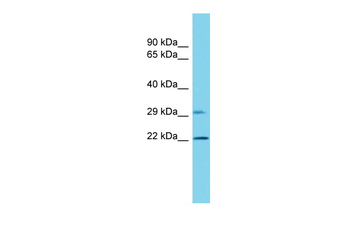 Vps25 Rabbit Polyclonal Antibody