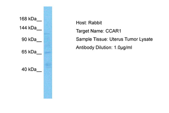 CCAR1 Rabbit Polyclonal Antibody