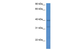 MTNR1A Rabbit Polyclonal Antibody