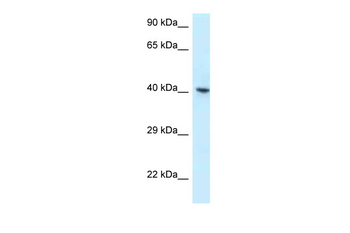 RBMX Rabbit Polyclonal Antibody