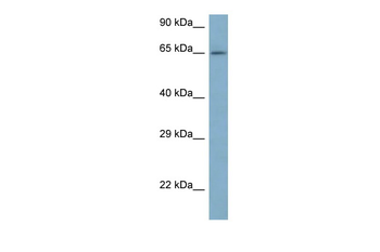 ARFGAP3 Rabbit Polyclonal Antibody
