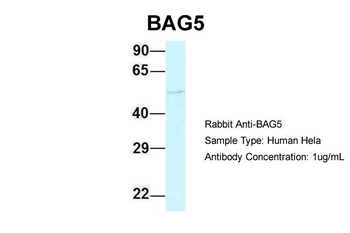 BAG5 Rabbit Polyclonal Antibody