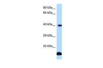 CD1D Rabbit Polyclonal Antibody
