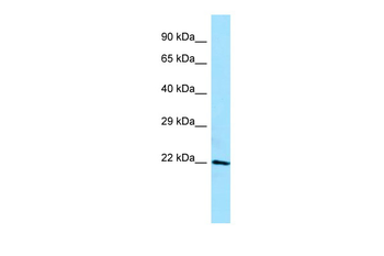 APOM Rabbit Polyclonal Antibody