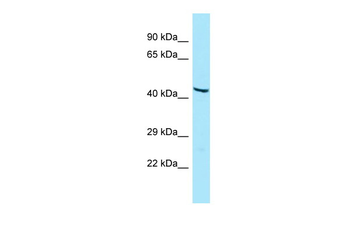 GIPR Rabbit Polyclonal Antibody