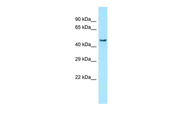 PRKAG3 Rabbit Polyclonal Antibody