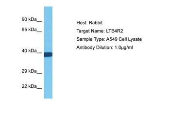LTB4R2 Rabbit Polyclonal Antibody