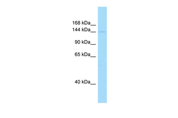 PIK3C2A Rabbit Polyclonal Antibody