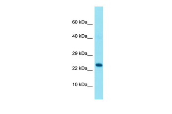 GRAP Rabbit Polyclonal Antibody