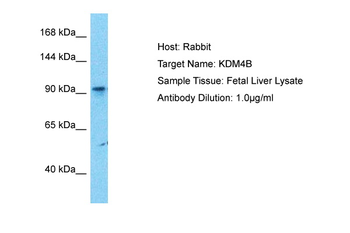 KDM4B Rabbit Polyclonal Antibody