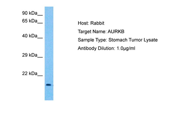 AURKB Rabbit Polyclonal Antibody