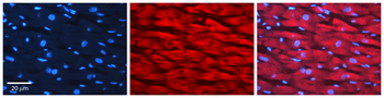 LSP1 Rabbit Polyclonal Antibody