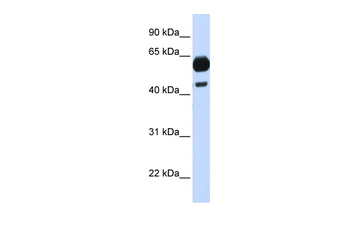 CDC25A Rabbit Polyclonal Antibody