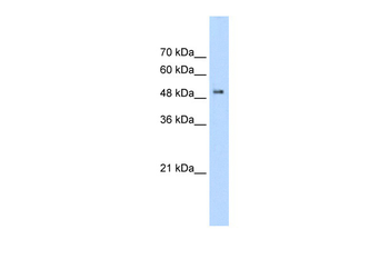 PACSIN1 Rabbit Polyclonal Antibody