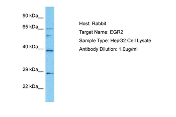 EGR2 Rabbit Polyclonal Antibody