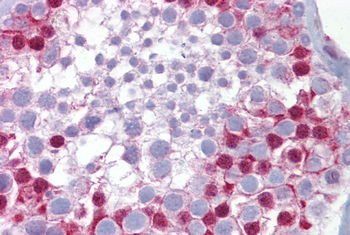 SP7 Rabbit Polyclonal Antibody