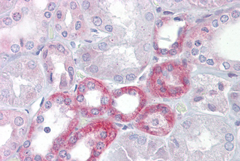 KL Rabbit Polyclonal Antibody