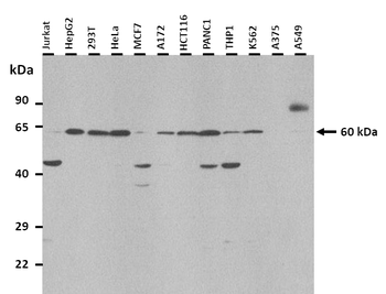 HP Rabbit Polyclonal Antibody