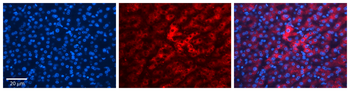 HP Rabbit Polyclonal Antibody
