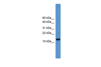CASP1 Rabbit Polyclonal Antibody