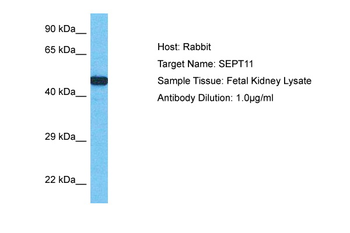 SEPT11 Rabbit Polyclonal Antibody