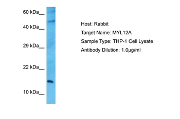 MYL12A Rabbit Polyclonal Antibody