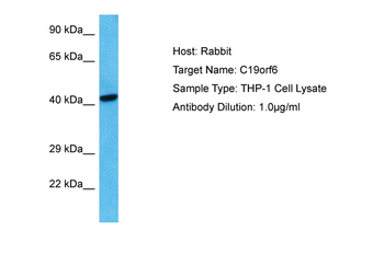 TMEM259 Rabbit Polyclonal Antibody