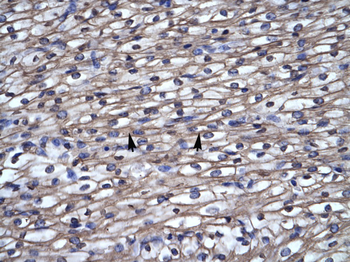 SEPT4 Rabbit Polyclonal Antibody