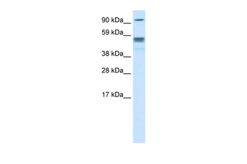 SEPT4 Rabbit Polyclonal Antibody